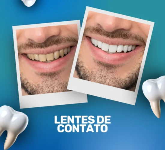 Lentes de Contato