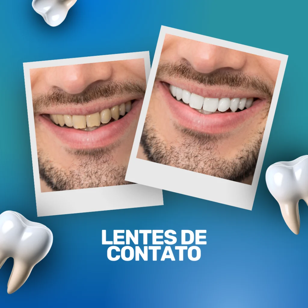 Lentes de Contato